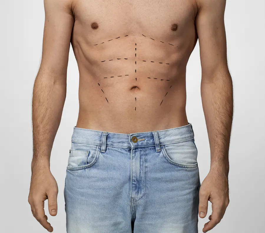 acido-hialuronico-hombre-landing-foto-lineas-en-torso-hombre